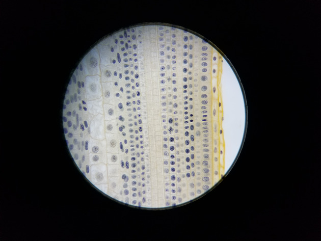 Onion Root Mitosis Slides - Onion Root  Mitosis  02 400X